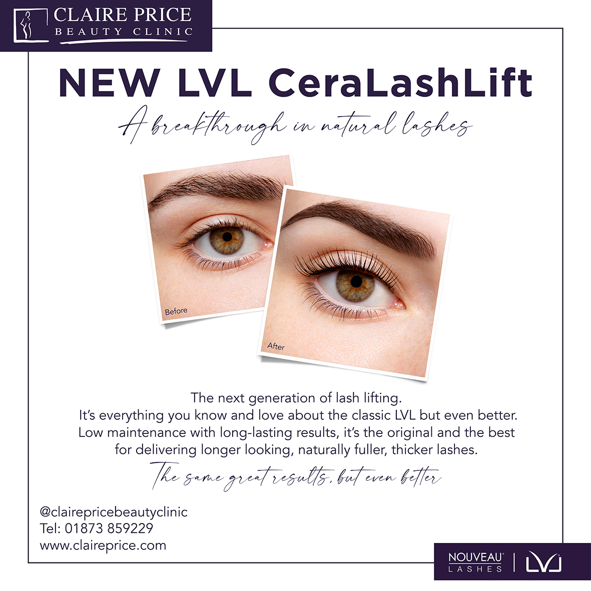 NEW LVL CeraLashLift
