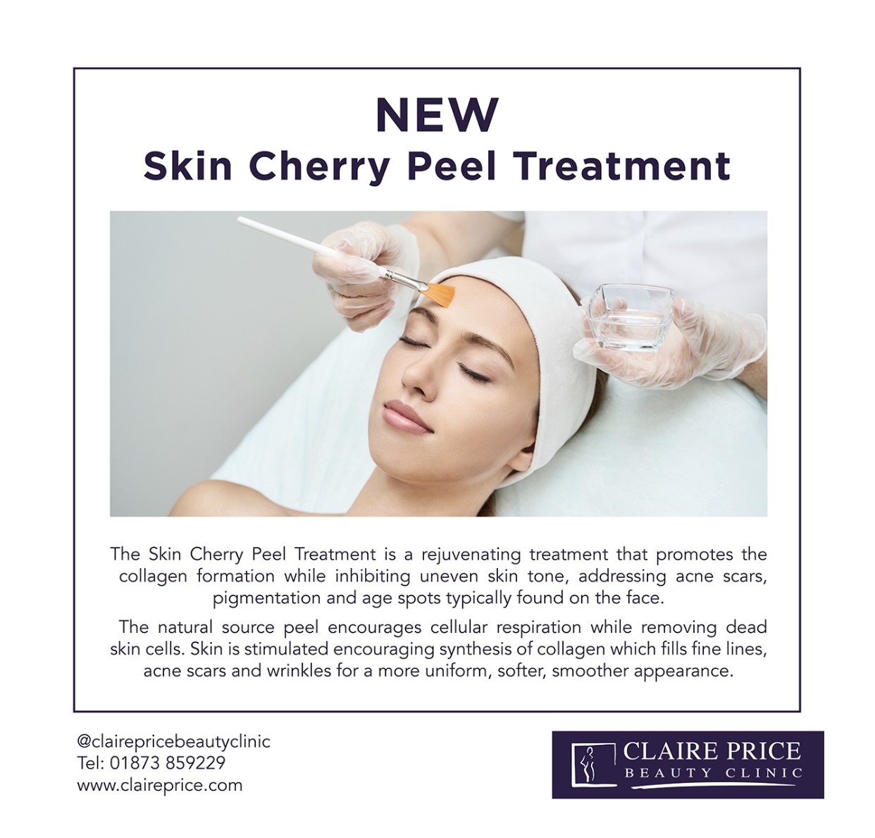 New Skin Cherry Peel Treatment