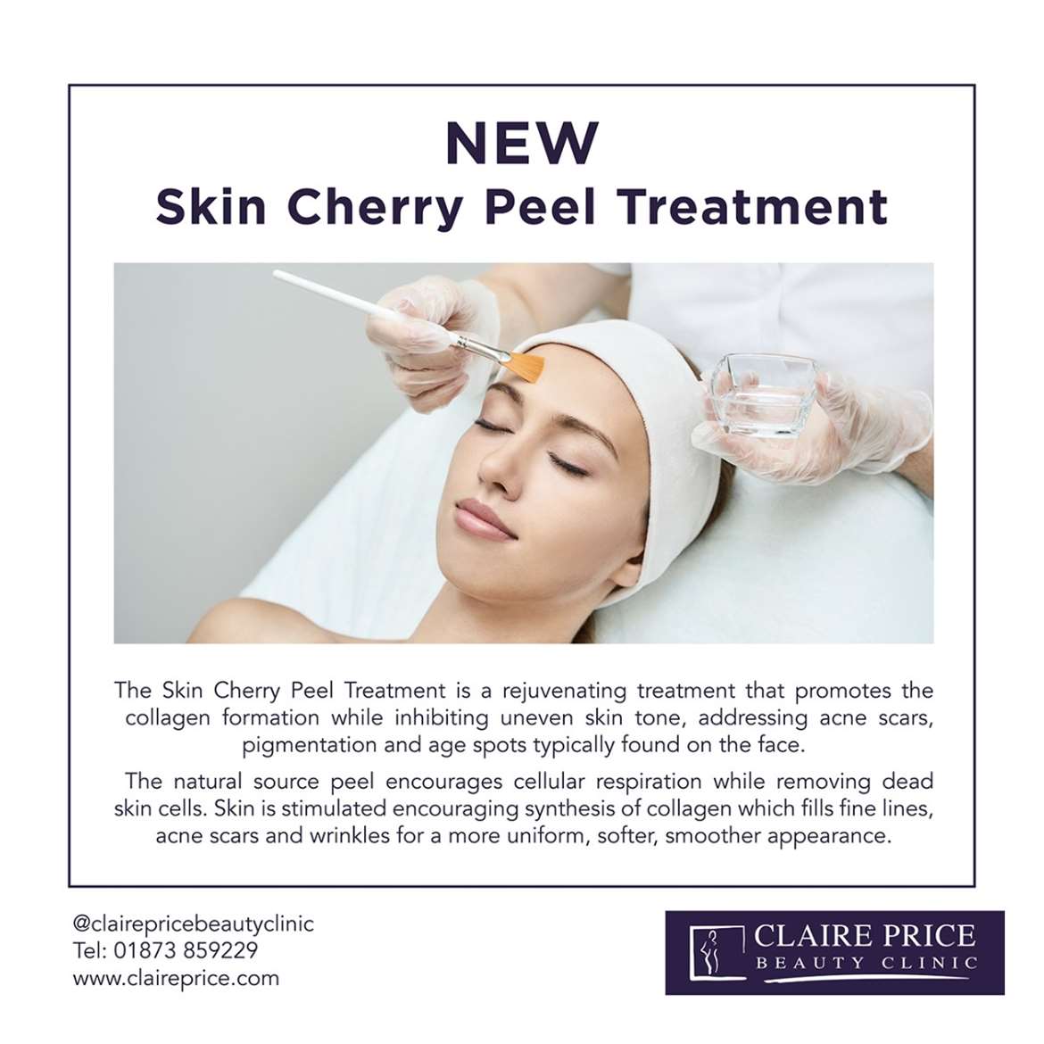 New Skin Cherry Peel Treatment